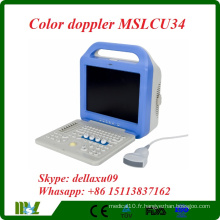 Scanner à ultrasons Doppler couleur portable portable (MDLCU34A) le plus cheré en 2016.